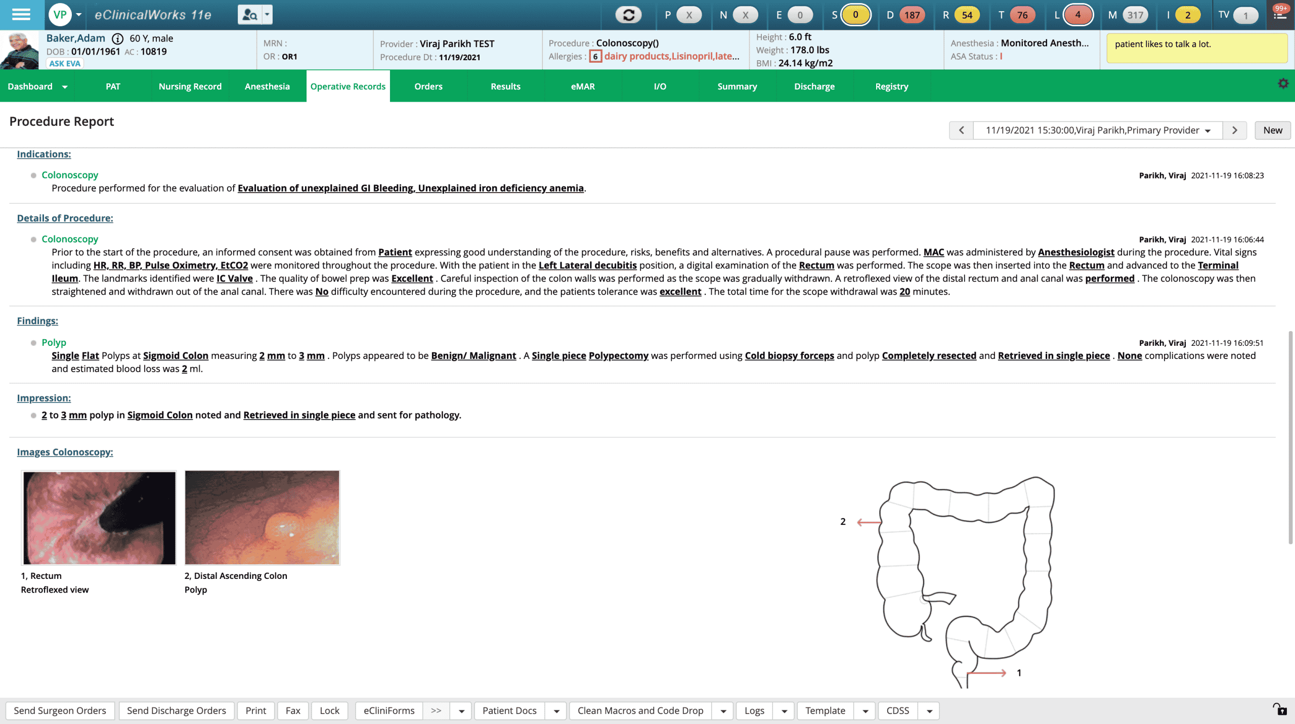 eClinicalWorks Gastroenterology Module Colonoscopy screenshot