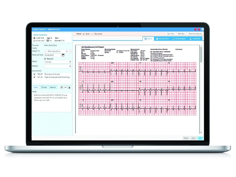 Cardiology ECG Report in eClinicalWorks EMR